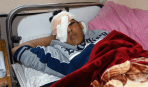 Mohammad al-Farani (14) a quien le dispararon en la cara con un cartucho de gas lacrimógeno, causándole fractura de cráneo y pérdida del ojo derecho.  loss of his right eye.&nbsp;(DCIP