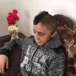 Muhammad Tamimi (14) después de ser sometido a una compleja operación para quitarle la bala que le entró por la mandíbula y se alojó en su cerebro, después que un soldado israelí le disparara a la cara, apenas cinco meses después de haber pasado un trimestre en la cárcel, acusado de tirar piedras. Tuvieron que quitarle un pedazo del cráneo para aliviar la presión sobre el cerebro, y se lo volverán a colocar dentro de seis&nbsp;meses.